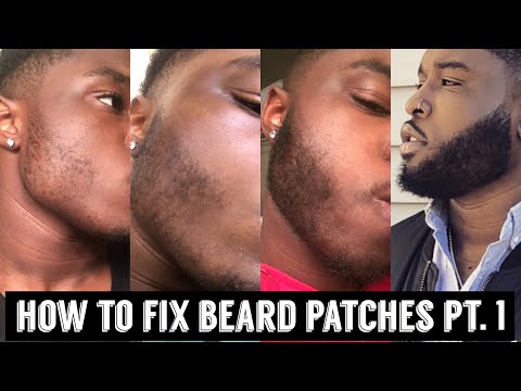 Come risolvere Barba Patch Pt. 1