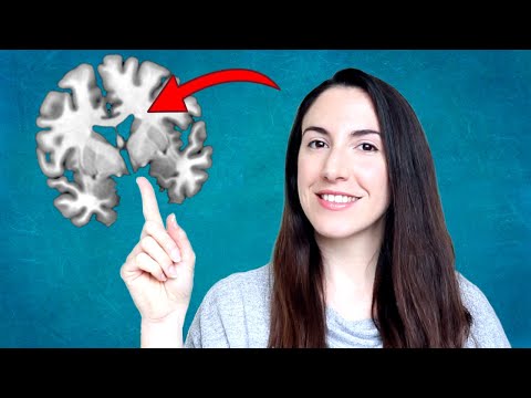 Video: ¿En la sustancia blanca del cerebelo?