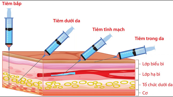 Hướng dẫn các cách tiêm cho đạt hiệu quả cao năm 2024