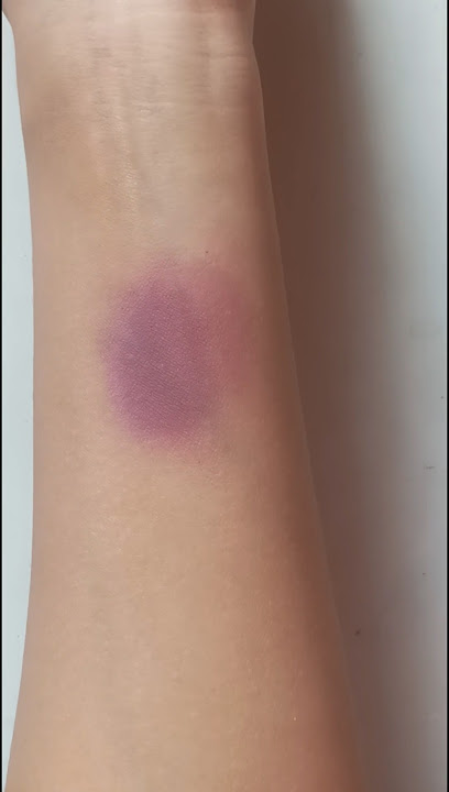 How to create fake bruises/ fake injury 🤕#trending #sfx #sfxmakeup #bruises #fakecut #fakeinjury