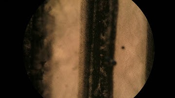 Electrohydrodynamic flow in ZrP