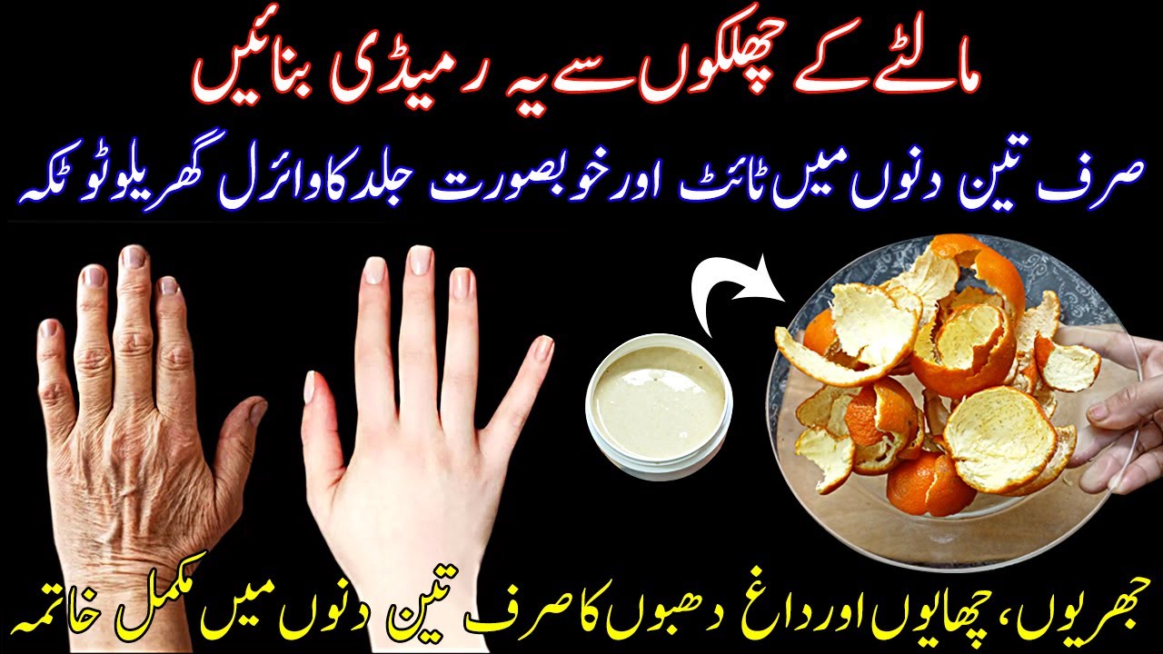 Viral Orange Peel Remedy For Tight,Spotless,Acne Free And Pigmentation Free Skin |DIY Skincare