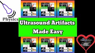 Ultrasound Artifacts of Physics