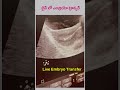 Embryo Transfer Process LIVE #drjyothi #embryotransfer #ferty9 #fertilitytreatment 📞89 777 38 912