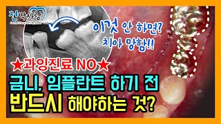 4-3.이런게 과잉진료 아닐까? 금니, 임플란트 하기 전 반드시 ⭐체크해야하는 것!!!⭐ 이거 안 하면 치아 망해요!!!😨 리얼 치과의사 꿀팁☝