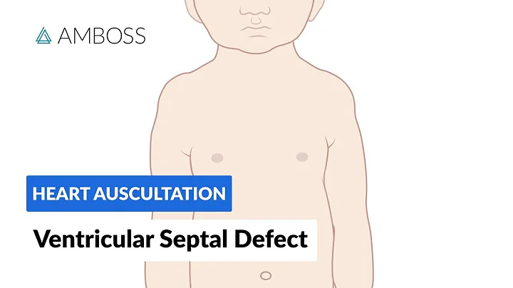 Ventricular Septal Defect (VSD) - Heart Auscultation - Episode 11 - DayDayNews