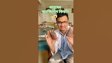 দেখুন মানুষের অরজিনাল কিডনি কেমন । #kidney #short #trending #ytshort #tiktok