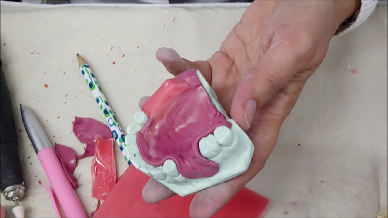 Placa base para desdentado parcial