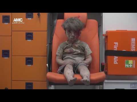 Omran Daqneesh saved after an airstrike near Aleppo in Syria