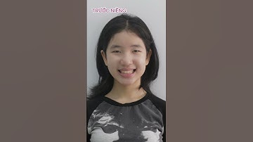 Nụ cười tự tin và năng lượng tích cực sau niềng răng | #shorts