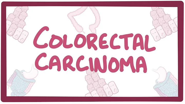 Colorectal carcinoma - causes, symptoms, diagnosis, treatment, pathology - DayDayNews