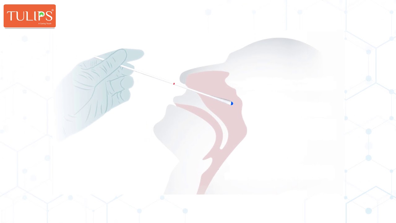 100% Polyester Swab for Nasopharyngeal  & Oropharyngeal by Tulips