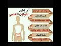 علاج بومزوي القولون العصبي واعصاب المعدة بروتين سهل وبسيط