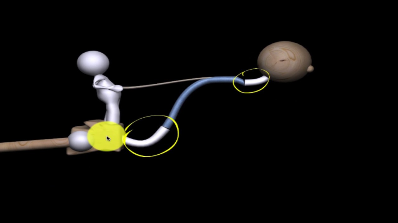 Kyfose - structureel probleem (nekpijn - rugklachten)