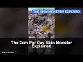 The 2cm Per Day Skin Monster Explained
