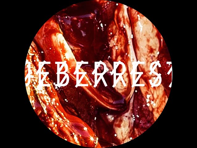 Ueberrest - You Know What  [R009]