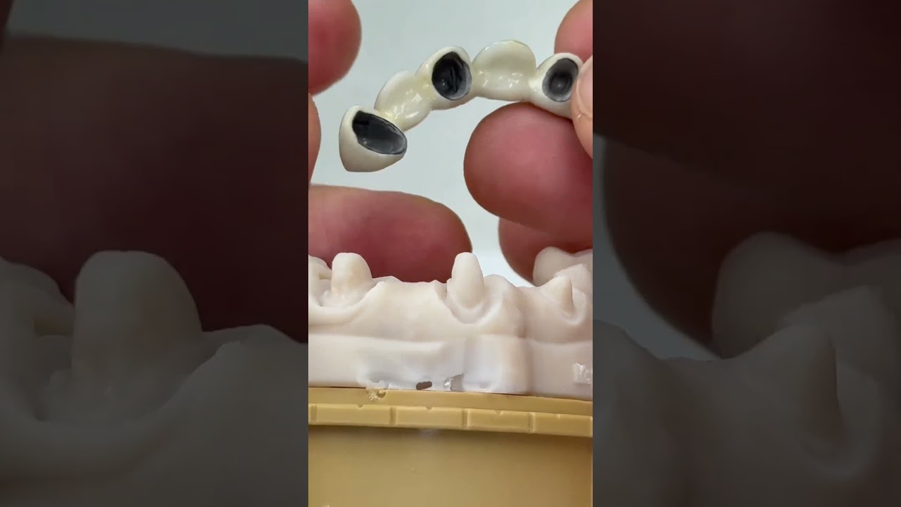 Old school lab techniques but still good!