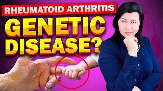 Is Rheumatoid Arthritis a Genetic Disease? Resimi