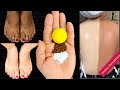 सालों साल जमी मैल व गंदगी शरीर से मिनटों में साफ़ करें Remove Dirt ,Dead skin cells in just 1 time