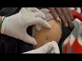 How to administer Intramuscular injection #injection #nurse #atithinursingshorts