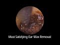 Most Satisfying Ear Wax Removal With Relaxing Music