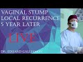 Vaginal stump local recurrence 5 year later / Местный рецидив,культя влагалища,5 лет после гистерэкт