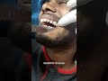 What kind of braces are these!? 🤯