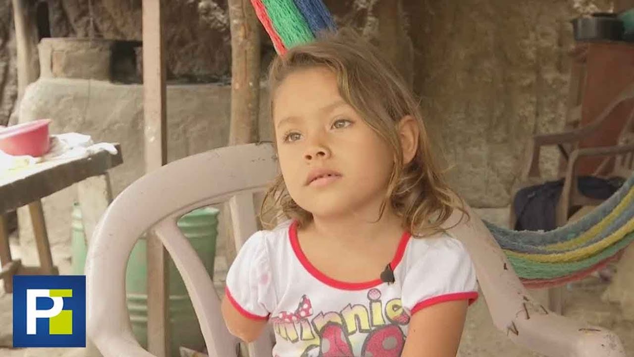Niña salvadoreña perdió su pierna y su brazo en un aparatoso accidente y ahora no puede ir a la escu