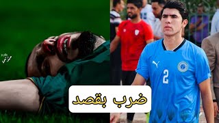 شاهد بصمة اللاعب احمد خالد لاعب الطلبة بعد ضرب المواس في المباراة