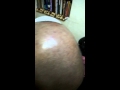 Hair loss effect no hair....bald look on head