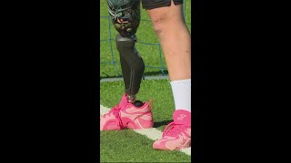 Fundraiser at Children&#39;s Museum of Indianapolis raises money for kids with limb loss