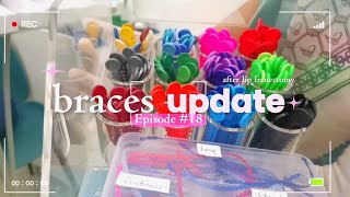 #BracesUpdate🦷: Adjustment | Buccal Tube &amp; Bracket Reattachment 