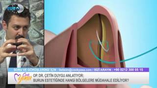 Burun Estetiği Ve Saç Ekimi Euro D 26.04.2017