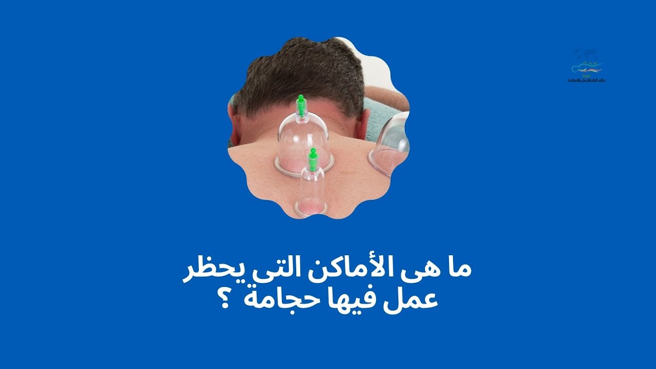 ما هى الأماكن التى يحظر عمل بها حجامة ؟