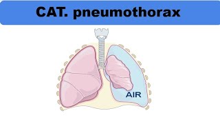 Conduite à tenir devant un pneumothorax