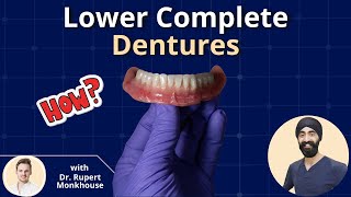 Lower Complete Dentures  PDP073