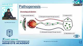 Management of Viral keratitis | Dr. Aya Hashish