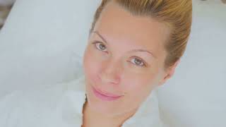 Reduce Wrinkles With Tria Beauty Age Defying Laser