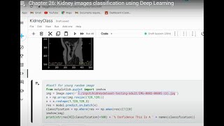 Celebrity Chapter 26: Kidney images classification using Deep Learning Wealth