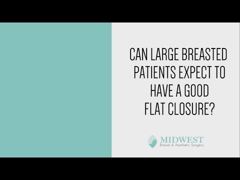 Q&A: Can Large Breasted Patients Expect to Have a Good Flat