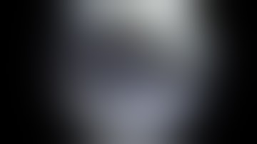 Arthroscopic Rotator Cuff Repair (Subscapularis Repair) - Patient Version