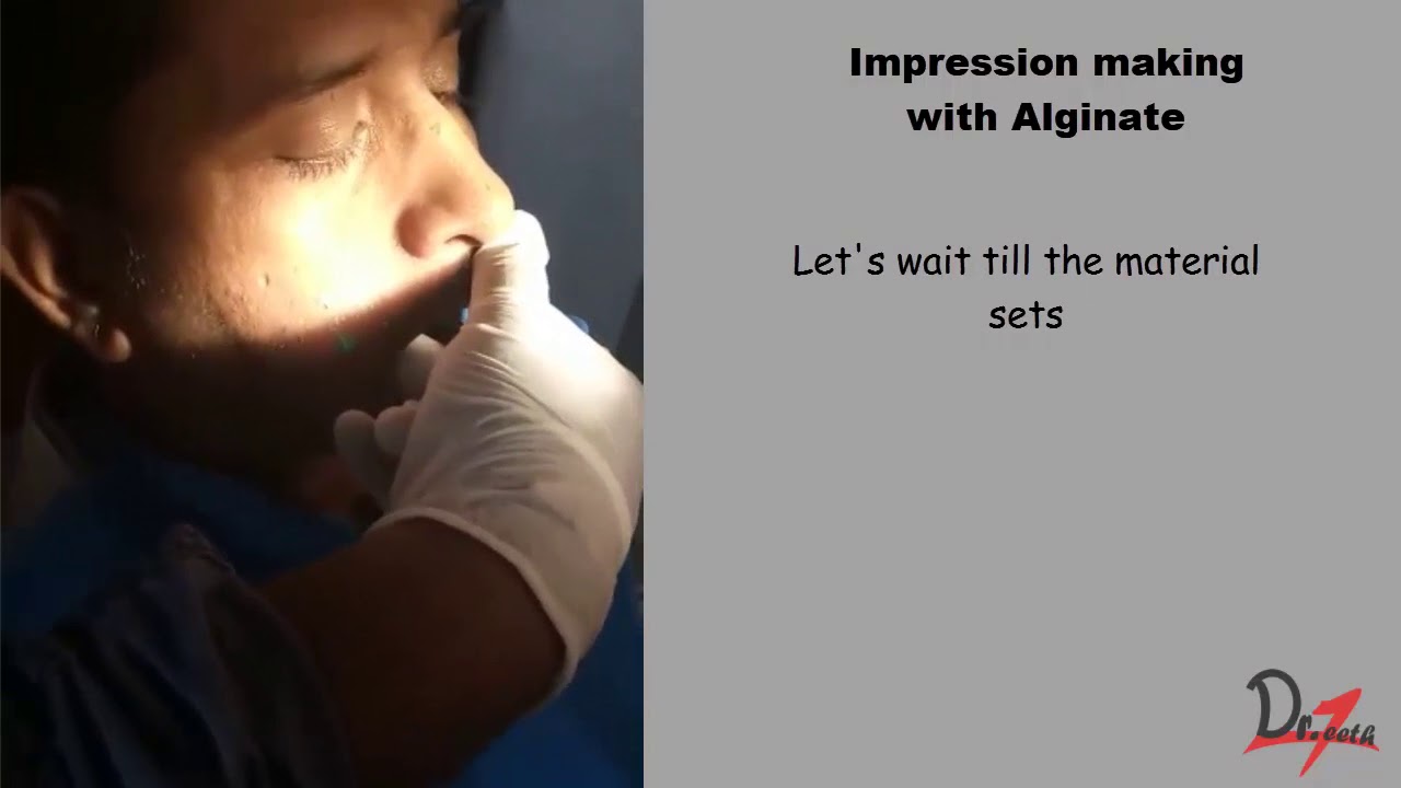 Perfect Alginate impression Demo YouTube