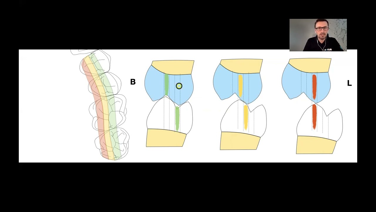 #3 Echilibrari ocluzale