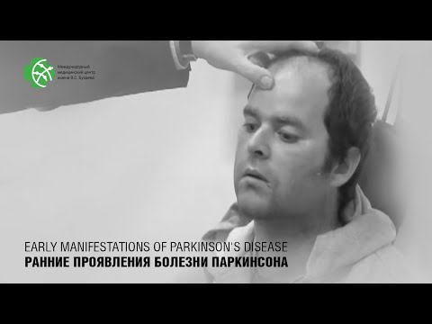 Ранние проявления БОЛЕЗНИ ПАРКИНСОНА. Краткая характеристика медикаментозного лечения.