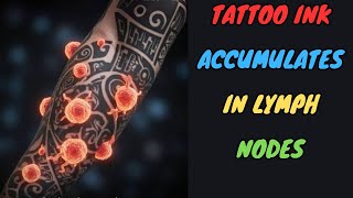 TATTOO INK ACCUMULATES IN LYMPH NODES
