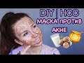 DIY: ТОП Бюджетна маска против акне 💯