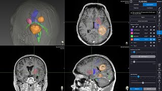 Navient Automatic Brain Segmentation