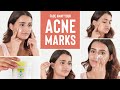 ACNE MARKS? We have the ultimate solution for CLEAR SKIN!