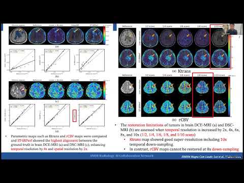 Clinical Application of AI and Deep Learning in Brain Tumor imaging – A Deep Dive.