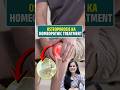 Osteoporosis Ka Homeopathic Treatment #Osteoporosis #Homeopathy #BoneHealth #StrongBones #shorts